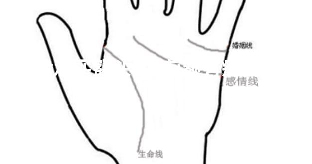 千金难买额头痣,前额有痣多半吉相
